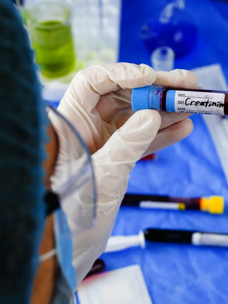 Diagnóstico y evaluación de la creatinina alta