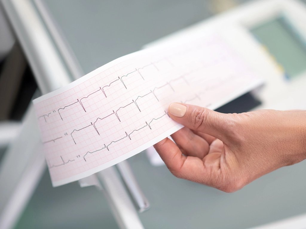 Un electrocardiograma revela en minutos lo que tu corazón no dice con palabras