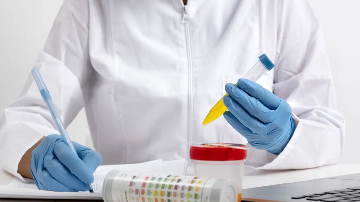 Leucocitos en la orina: causas y cuándo consultar