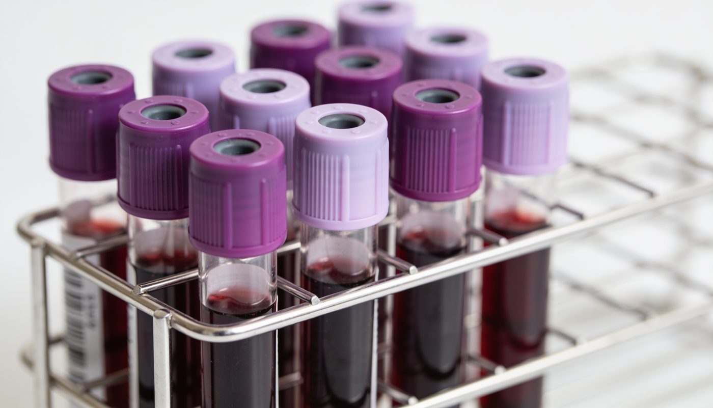 Lupus y riñones: qué es la nefritis lúpica y por qué importa el seguimiento