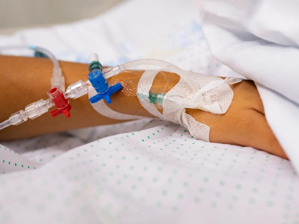 Síndrome de lisis tumoral y control del ácido úrico: evita complicaciones renales durante tu tratamiento oncológico