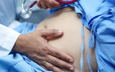 Diálisis peritoneal: tratamiento renal en casa con autonomía y seguridad